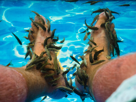 Kangal fishes nibbling man's callused skin at feet