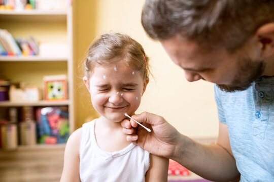 Father at home caring for daughter having chickenpox