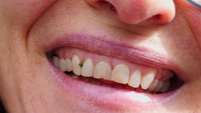 Extreme close-up of a smiling woman with a small piece of lettuce stuck between her front teeth, illustrating an awkward everyday moment and dental hygiene concept.