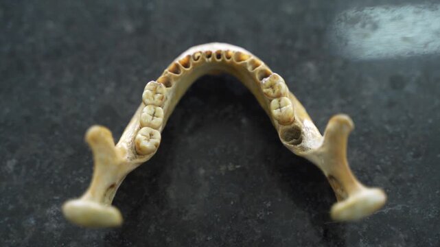 The jaw of a deceased person
