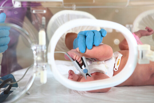 Doctor attaches sensor to baby's tiny foot inside an incubator. Neonatal intensive care unit. Saving lives. Medical support