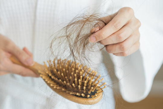 Stress asian young woman, girl hand holding comb show her hairbrush with loss, hair in brush after brushing, hair fall out problem. Health care, beauty with treatment concept, isolated on background.