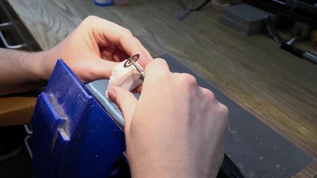 Close-up view of a dental technician's hands carefully using a rotary tool with a grinding disc to precisely shape and finish a white plaster cast model of a human jaw in a laboratory