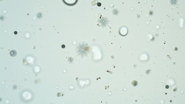 Microscopic Milk Emulsion Analysis