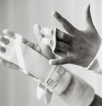Child hands wearing adaptive finger splints and wrist brace during rehabilitation exercise in bright clinical therapy room, close-up of supportive foam padding and straps