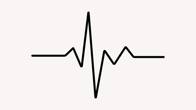 Black electrocardiogram line on a light background symbolizing a healthy heartbeat
