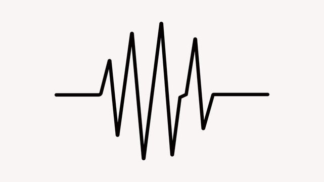 Complex black electrocardiogram waveform on a light background indicating a rapid pulse