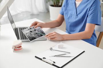 Dental diagnosis and oral healthcare consultation, dentist examining patient x-ray scan on laptop...