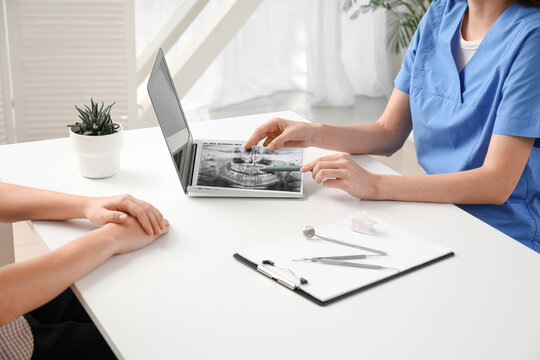 Dental consultation and oral health diagnosis, dentist explaining panoramic x-ray to patient on laptop in clinic office for treatment planning