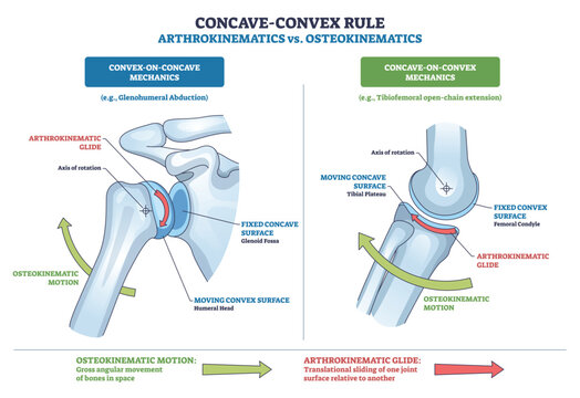 Concave-convex rule contrasts arthrokinematics vs osteokinematics, showing joint glide and bone motion with shoulder and knee joints and direction arrows. Outline diagram