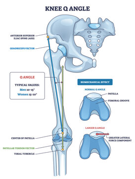 Knee Q angle overview showing pelvis, patella, and tibial tubercle vectors to explain patellar tracking and alignment forces of the lower limb. Outline diagram
