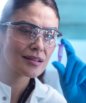 Female scientist analyzes blood sample for neurology trial in lab