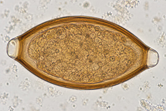 Whipworm Egg Under Light Microscope