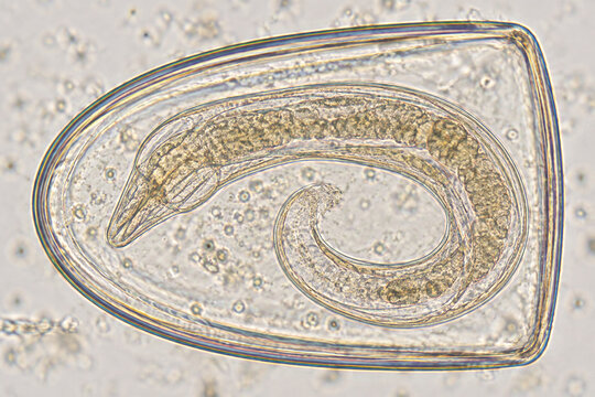 Pinworm Egg With Coiled Larva Under Microscope