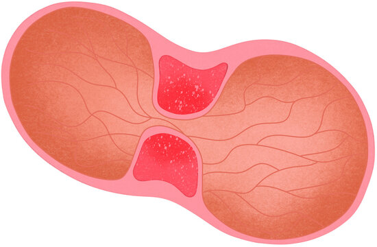 pyloric valve illustration