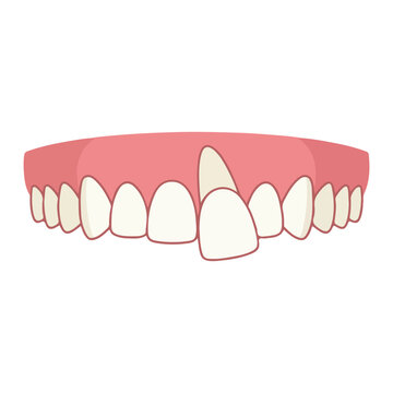 Crooked misaligned dental teeth and gums for orthodontic oral health care
