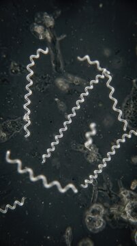 Microbe spiral form: Syphilis infection, Treponema pallidum, darkfield microscopy, bacterial pathogen, helix cell, disease agent, corkscrew shape, medical research, active spirochaete.