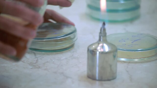 Closeup microbiologist hands opening petri dish near burner flame. Lab test.