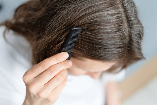 Close up of a woman experiencing both hair fall and premature graying together. The mature adult faces compounded challenge of aging hair problems. Mother feels cursed by double hair misfortune.