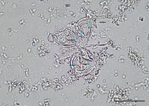 soil microorganisms under a microscope including amoeba, flagellates, nematodes, fungi, bacteria