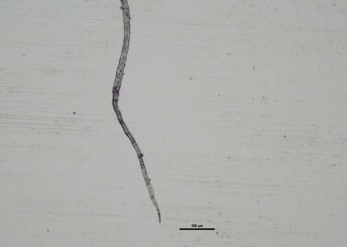 soil microorganisms under a microscope including amoeba, flagellates, nematodes, fungi, bacteria