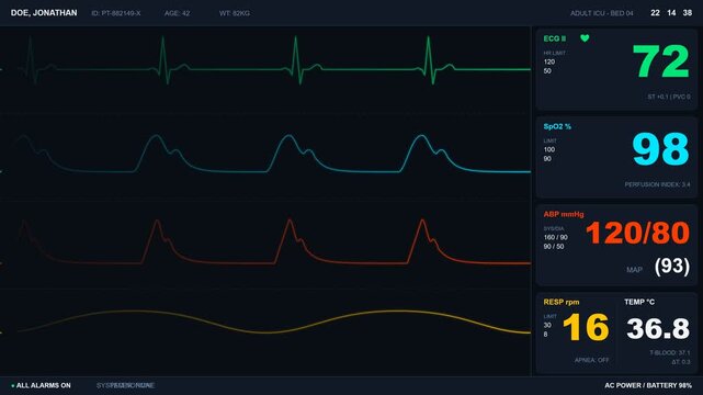 Patient vital signs monitor screen showing ECG heart rate and SpO2 waveforms in 4K seamless loop motion graphics