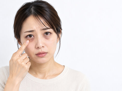 指で目の下のクマを指し示す困った表情の日本人女性　白背景のスキンケア悩みイメージ