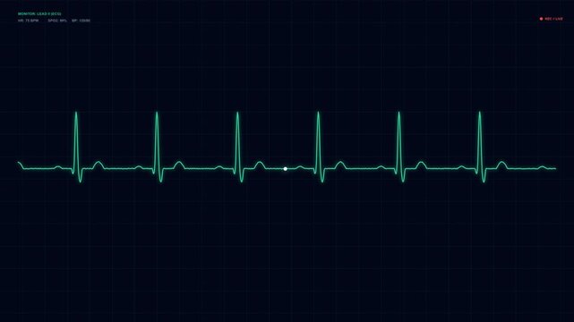 Medical ECG EKG Heartbeat Monitor Screen Animation, Seamless Green Neon Heart Rate Waveform, Cardiac Monitoring and Digital Healthcare Technology