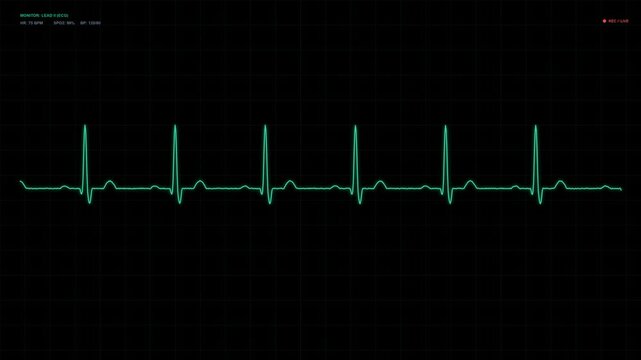 Medical Patient Monitor Boot-Up Animation in 4K, EKG ECG Heartbeat Pulse Waveform Loading Sequence, Cardiac Monitoring Screen, Hospital Medical Equipment, Healthcare Technology and Digital Interface
