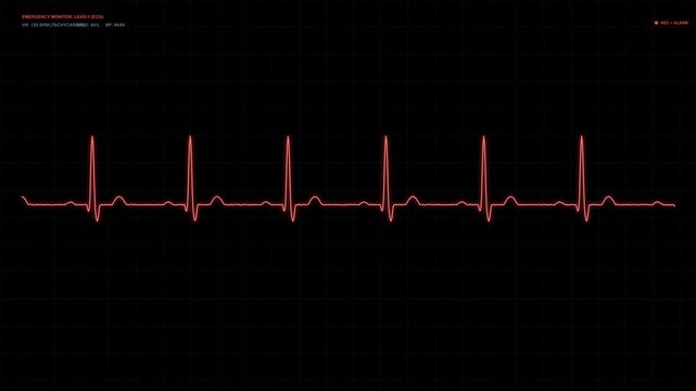 Emergency Code Red ECG Monitor Animation in 4K, Fast Tachycardia Heartbeat Pulse Waveform, Red Neon Medical Alert, Cardiac Monitoring Screen, Critical Condition, Hospital Emergency and Healthcare Inte