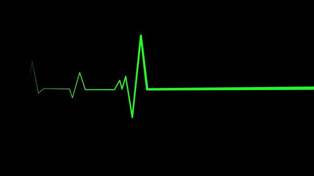 Electrocardiogram Heartbeat Wave Animation with Medical Signal Line