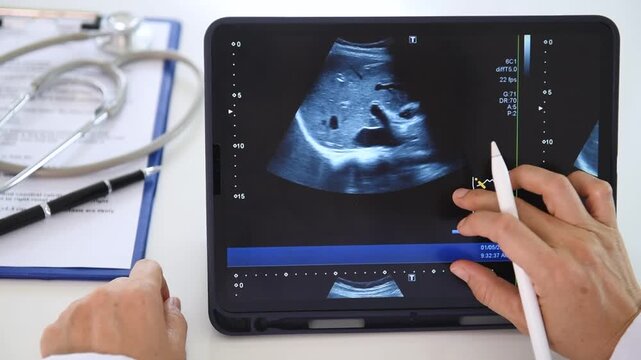 Radiologist or Surgeon doctor looks result of mammography on digital tablet to diagnose breast  cancer from mammogram at medical center.