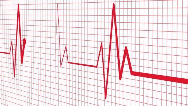 Digital Heartbeat Wave Animation with Medical ECG Signal Display