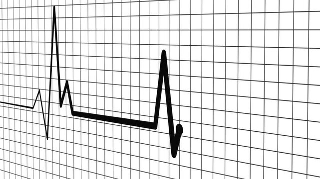 Cardiology Monitor Animation Featuring Heart Rate Wave Signal