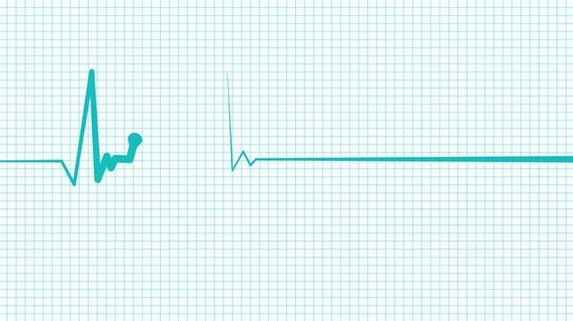 Modern Healthcare ECG Animation with Cardiac Monitoring Line