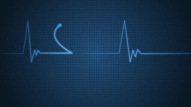 Healthcare Heartbeat Signal Motion Graphic for Medical Projects