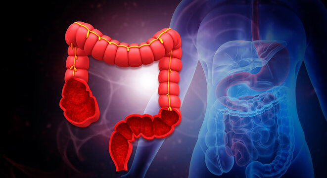 Detailed human colon anatomy on blue medical background representing digestive health, gastroenterology, medical research and healthcare concept.