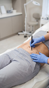 Cosmetic Surgery Consultation and Preoperative Body Mapping