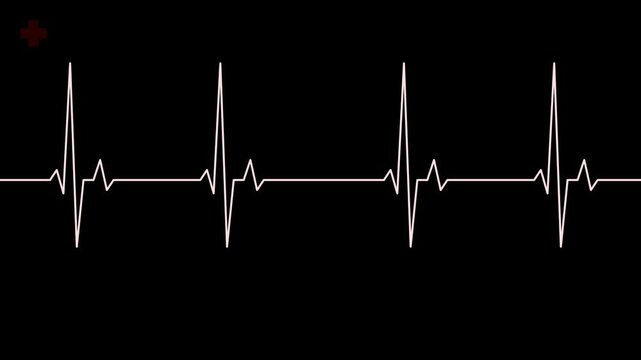 Electrocardiogram heart rate monitor displaying normal sinus rhythm electrocardiography waveform trace on black screen.