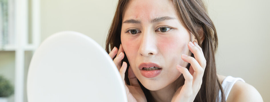 Asian young woman looking face skin in the mirror have a red rash on her face from cosmetic allergy