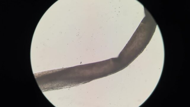 Pubic Hair Shaft Longitudinal Cortex Striations After Depilatory Cream Microscopy
