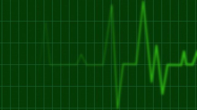 Health heartbeat green color line, showing and heart rhythm, medical monitor trace animation.4k video