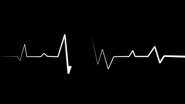 Heartbeat line white color and trace medical background. showing a medical ecg pattern heartbeat line.4k video