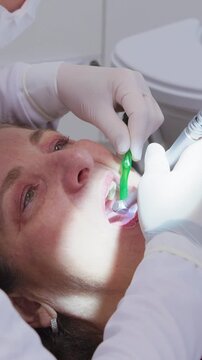 &bull; dentist treating a patient and performing a tooth restoration
&bull; Professional dentist hands performing dental tooth restoration on a patient
Close-up of a dentist doing a composite filling and tooth