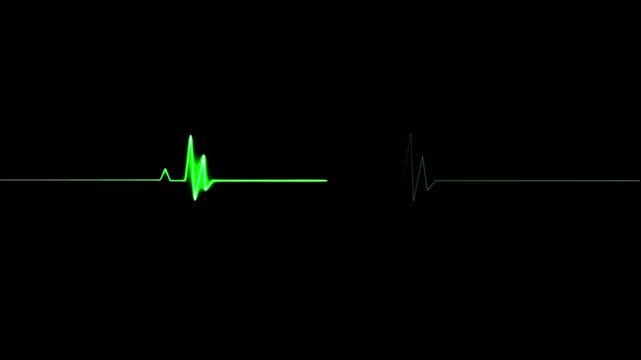Cardiac arrest on the medical monitor, heart stops beating. Heart beating then hearts deadline on black background. Seamlessly loop footage.