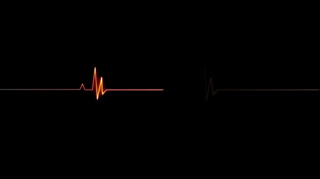 Cardiac arrest on the medical monitor, heart stops beating. Heart beating then hearts deadline on black background. Seamlessly loop footage.