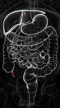 The appendix is a small, tube-shaped structure attached to the beginning of the large intestine, located near the junction of the small and large intestines in UHD | Appendicitis Vertical Video