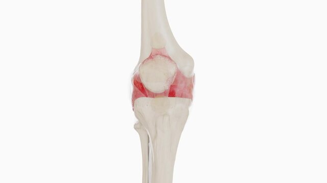 Knee joint pain refers to discomfort or pain affecting the knee, involving the bones, cartilage, ligaments, tendons, or surrounding tissues | Regenerative medicine Video