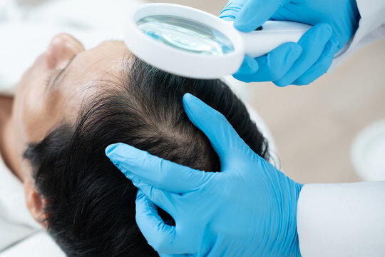 Specialist of hair check health of hair for Asian man, damaged hair, hair loss, thinning problem, vitamin deficiency, baldness, postpartum, biotin, zinc, endocrine disorders, hormonal imbalance