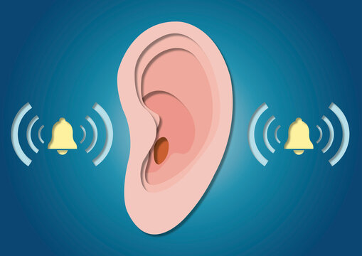 Tinnitus, conceptual illustration
